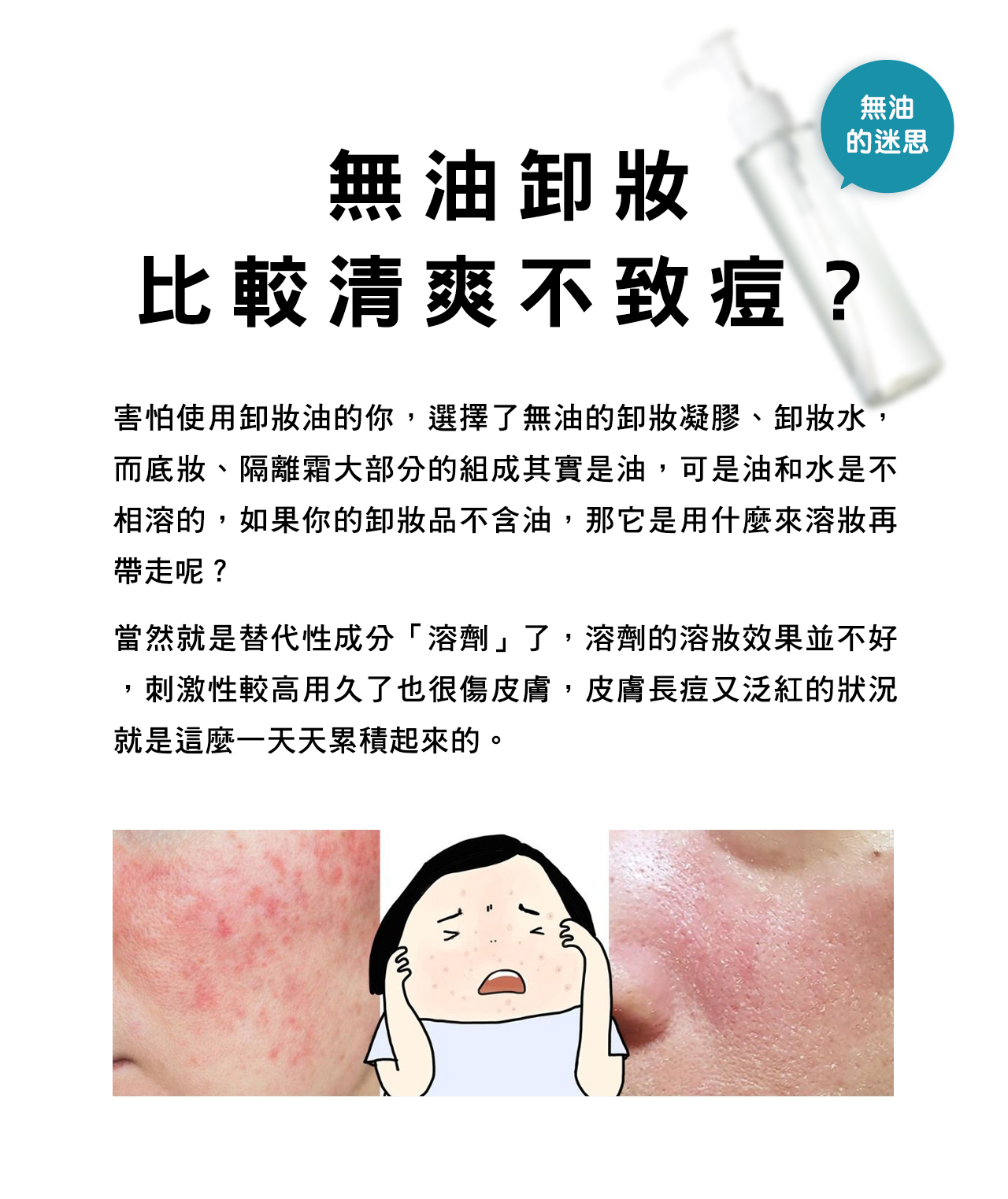 害怕使用卸妝油的你，選擇了無油的卸妝凝膠、卸妝水，而底妝、隔離霜大部分的組成其實是油，可是油和水是不相溶的，如果你的卸妝品不含油，那它是用什麼來溶妝再帶走呢？當然就是替代性成分「溶劑」了，溶劑的溶妝效果並不好，刺激性較高用久了也很傷皮膚，皮膚長痘又泛紅的狀況就是這麼一天天累積起來的。